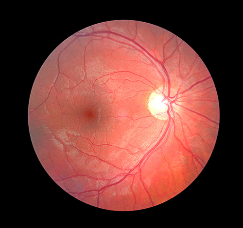oct retinal camera